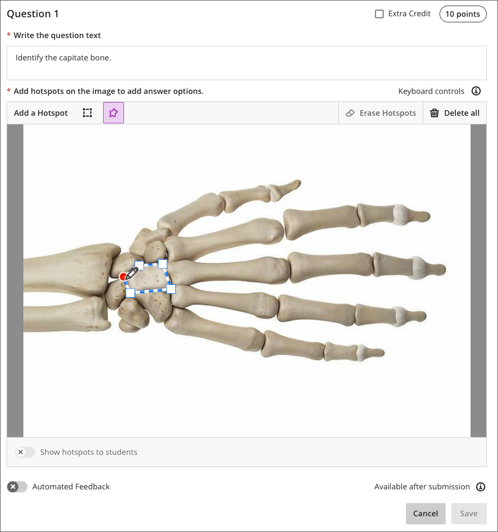 screenshot of a hotspot question showing an irregular shape drawn as a target on an image of the bones in the hand